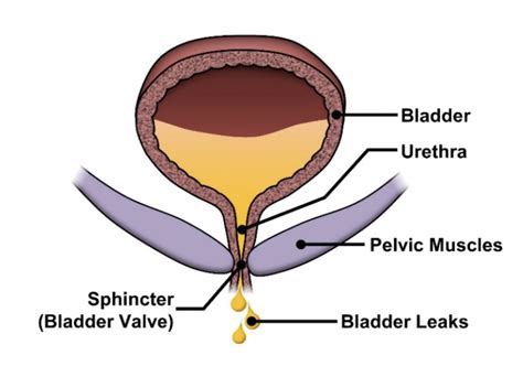 Bladder Dome Anatomy