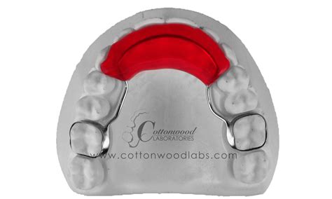 Cottonwood Labsfixed Bite Plate Anterior Guide Cottonwood Labs