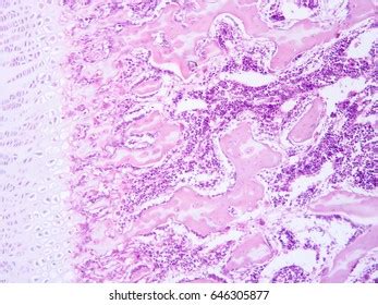 Histology Human Tissue Show Fibrous Cartilage Stock Photo 646305877 ...