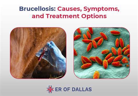 Brucellosis: Causes, Symptoms, and Treatment Options - ER of Dallas