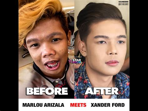 UMTC: Marketing Implications of Xander Ford Plastic Surgery