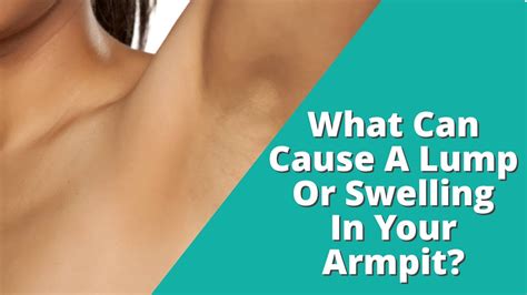 I Ve Found A Lump In My Armpit It Is Painful Could This Be Cancer