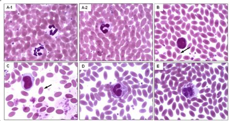 Morphology Of Different Types Of Leukocyte A 1 Segmented Neutrophils