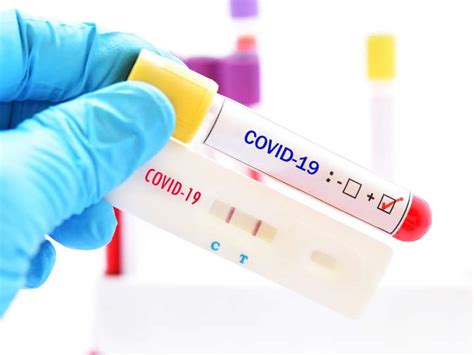 Jchc Now Offering Covid Antibody Testing