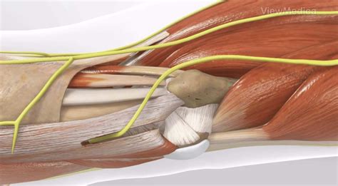 Cubital Tunnel Release | Double Board Certified Orthopedic Surgeons