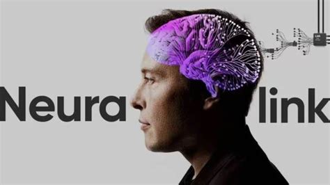 Neuralink Realiza Primer Implante Cerebral En Humano