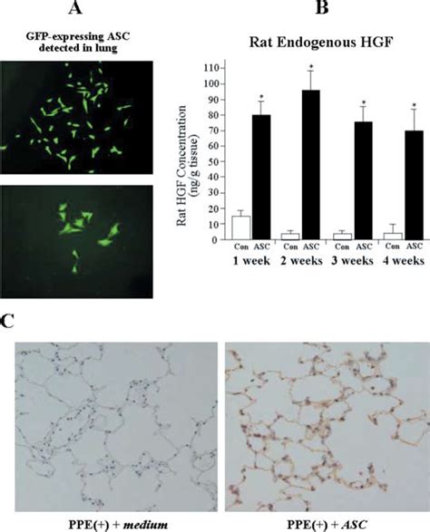 Autologous Transplantation Of Adipose Tissue Derived Stromal Cells