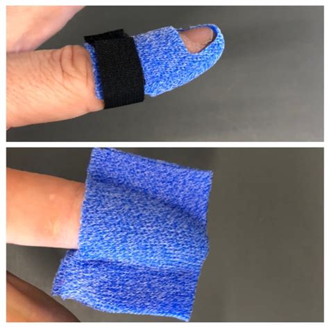 Volar Finger Splint