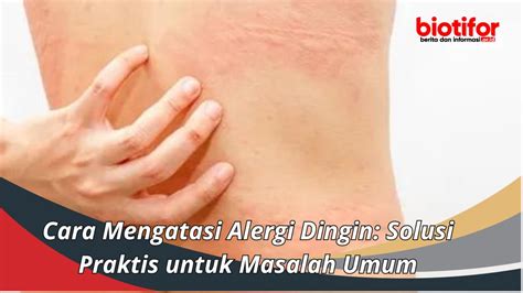 Cara Mengatasi Alergi Dingin Solusi Praktis Untuk Masalah Umum Biotifor