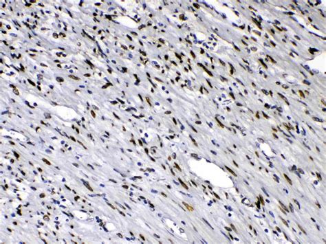 Emerin Antibody (PA5-79201)