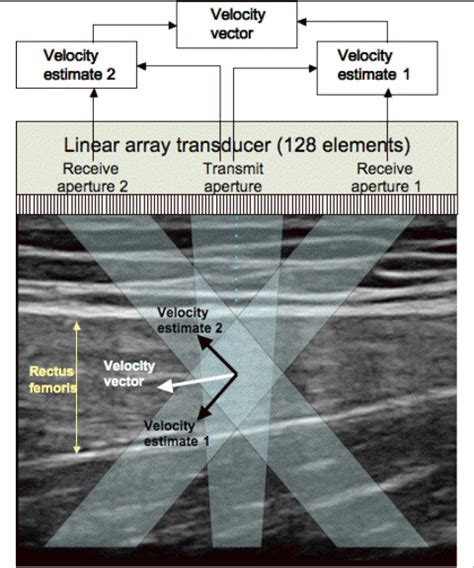 Schematic Describing The Vector Doppler Setup A Linear Array