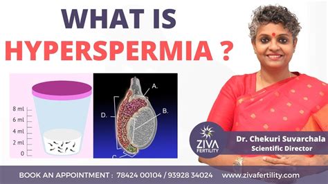 Understanding Hyperspermia Causes Symptoms And Treatment Options