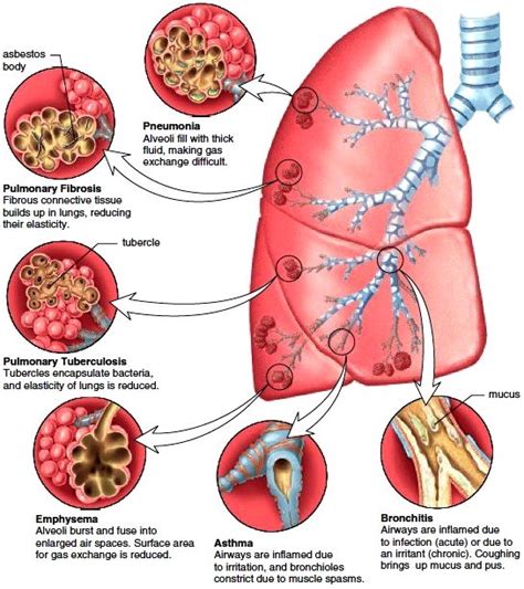 Pin On Medical