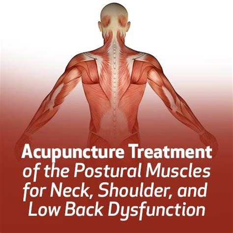 Acupuncture Treatment Postural Muscles Neck,Shoulder,Low Back | Lhasa OMS