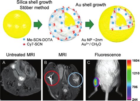 A Safer T1 Mri Contrast In A Compact Plasmonic Nanoparticle With