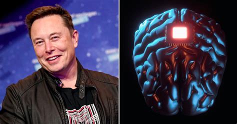 Elon Musk Aims To Start Implanting Brain Chips Into Humans Next Year