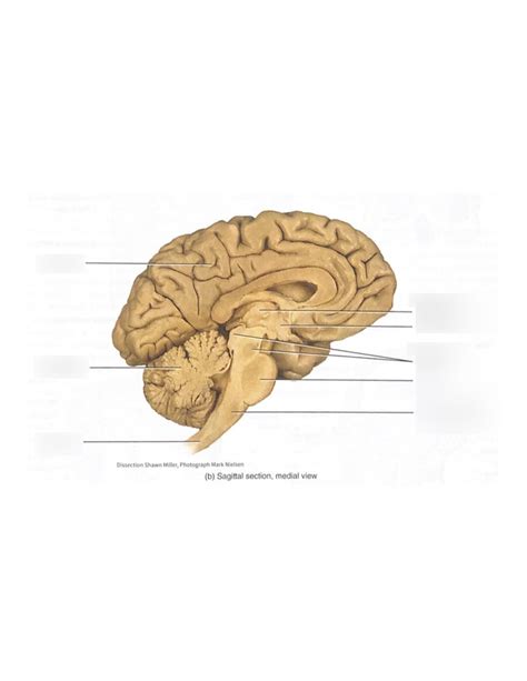 Medial View Of The Brian Diagram Quizlet