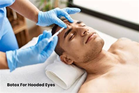 Botox For Hooded Eyes Treatments Advantages And More