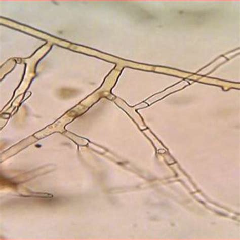 Rhizoctonia Solani Mycelium With Right Angled Branching And