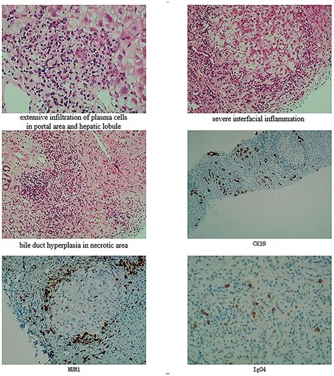 Histopathological Examination Using Light Microscopy Immunochemistry