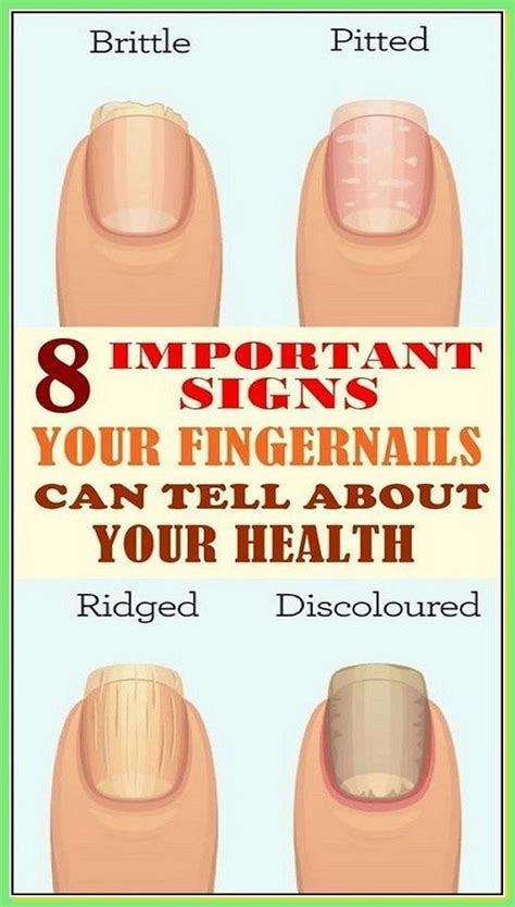 8 Important Signs Your Fingernails Can Tell About Your Health Artofit