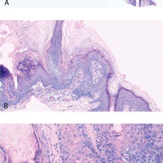 A, Follicular papillae surrounded by matrical cells of the bulb with... | Download Scientific ...