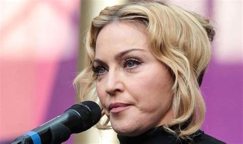 Madonna breaks the basic rules of plastic surgery and facial fillers ...