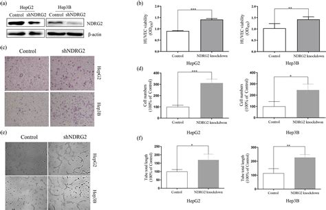 Ndrg2 Inhibition Facilitates Angiogenesis Of Hepatocellular Carcinoma