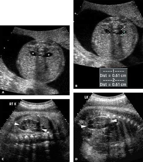 Genitourinary Tract Radiology Key