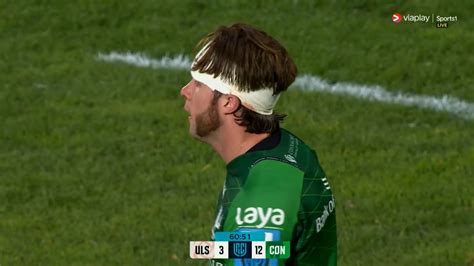 Connacht: Mack Hansen shares GRAPHIC pic of nasty gash after URC win | Flipboard