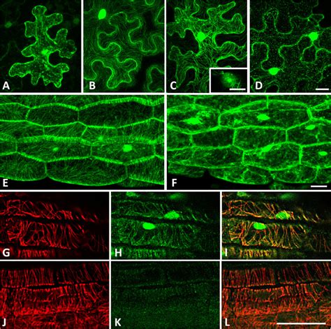 Gfp Tagged Iqd Proteins Localize To Microtubules And The Cell Nucleus