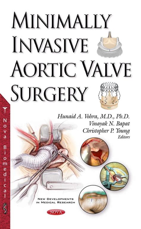 Minimally Invasive Aortic Valve Surgery – Nova Science Publishers