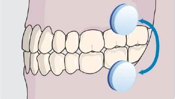 Lubricating Adhering Discs for Relief of Oral Dryness