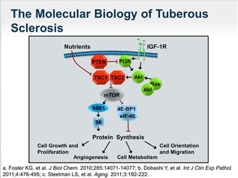 Managing Neurologic Manifestations Of Tuberous Sclerosis Complex