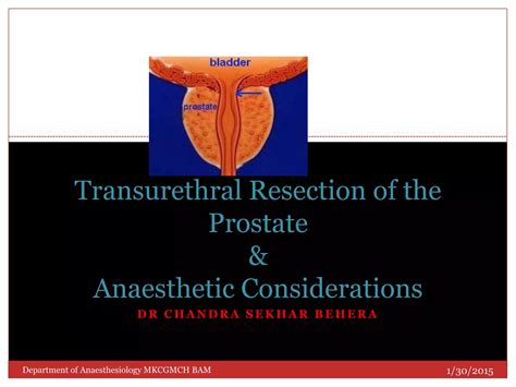 Transurethral Resection Of The Prostate Ppt