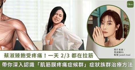 蔡淑臻飽受疼痛所苦！詳解「肌筋膜症候群」發生成因、症狀、高危險族群及治療方法 Heho健康