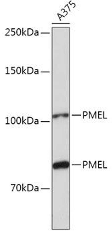 Anti Pmel 抗体 Assay Genie