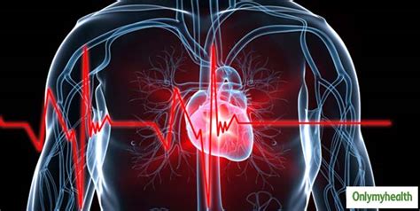 Sudden Cardiac Arrest Causes Symptoms Risk Factors And Prevention