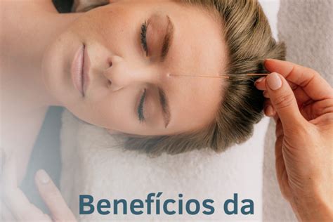 Acupuntura Na Gravidez Rede Movimente Fisioterapia E Pilates