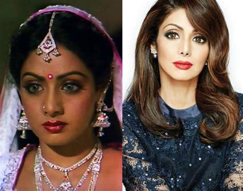 Bollywood Actresses That Got Skin Whitening Treatments Done Before