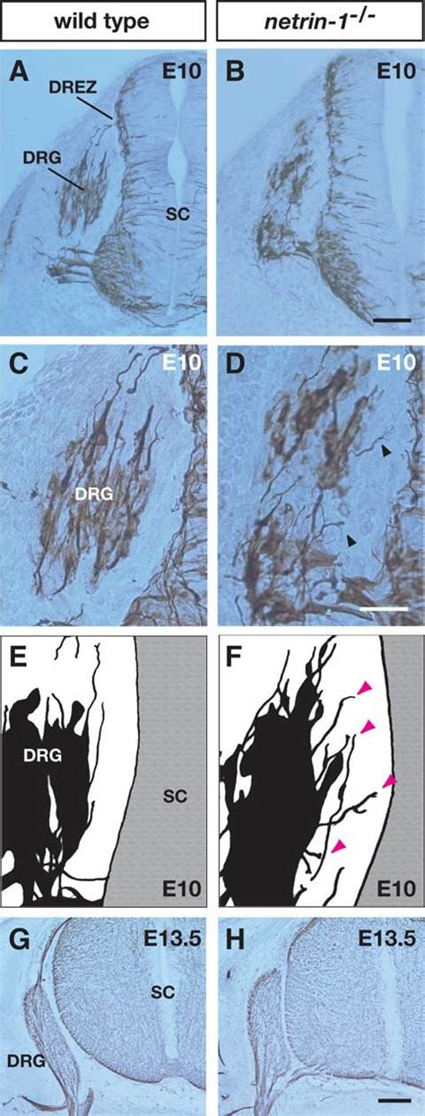 Defects in axonal trajectories at initial stages of DRG axonal ... 