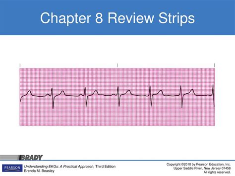 PPT - Atrial Fibrillation Rhythm PowerPoint Presentation, free download ...