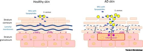 The Epidermal Lipid Barrier In Microbiomeskin Interaction Trends In