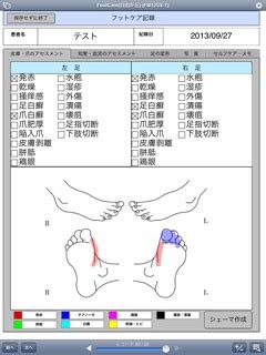 透析患者 フットケアチェックシート – 透析 フットケア 必要性 患者説明 資料 – XOIJO