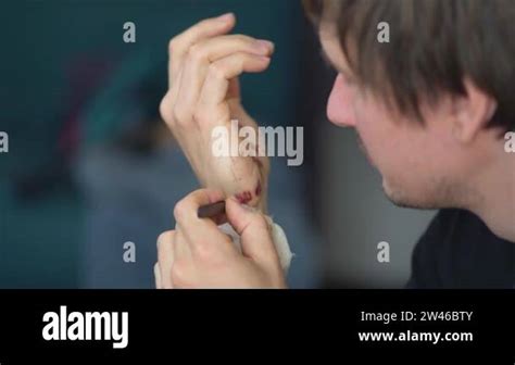 Man Cleaning A Bleeding Wound Under The Skin After The Accident