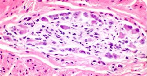 Myenteric Plexus Of Auerbach In The Canine Stomach High Power