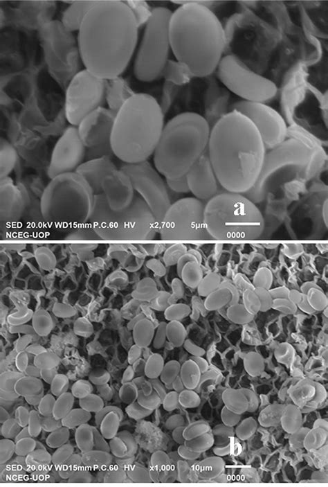 a-b. Scanning electron microscope (SEM) analysis of Basidiospores ...