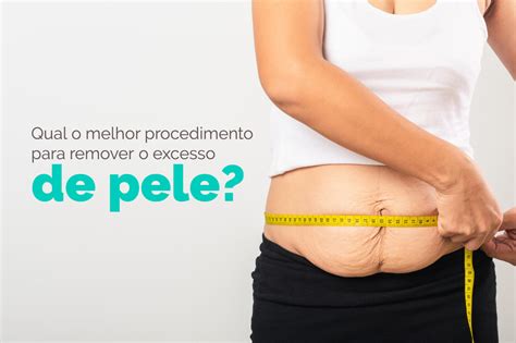 Qual O Melhor Procedimento Para Remover O Excesso De Pele Guia Sa De