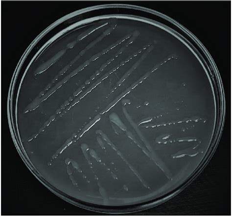 Colonies Of Leuconostoc Mesenteroides Bacteria Isolated On Yeast