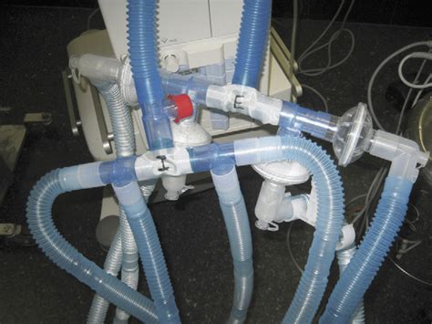 Modified Ventilator Circuit Download Scientific Diagram